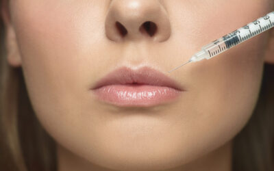 Dallas Plastic Surgeon to Performs Lip Augmentation