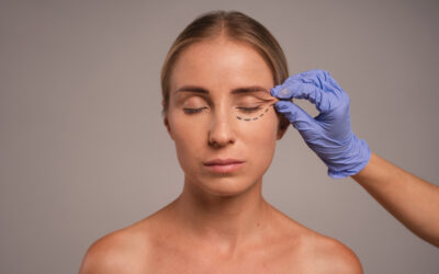 Texas Plastic Surgeon Defines Blepharoplasty