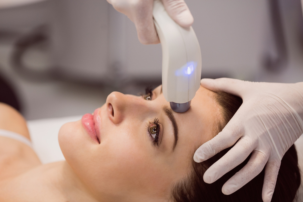 Laser resurfacing