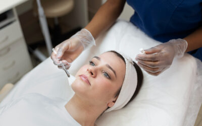 How a Chemical Peel Helps to Rid Surface Scars