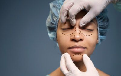 What Are the Benefits of a Nose Job?