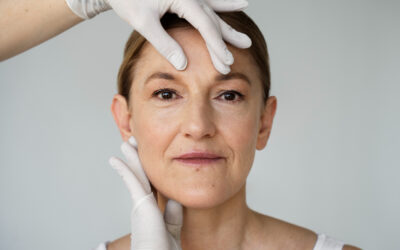 Benefits Of A Facelift