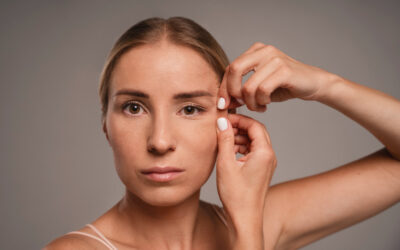 5 FAQs About Blepharoplasty