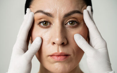 3 More Facelift FAQs