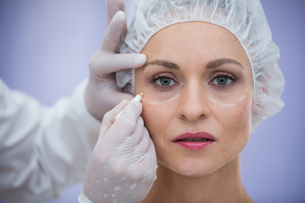 4 Facial Plastic Surgery FAQs About Cheek Implants