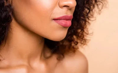 When To Choose A Lip Lift Over Fillers