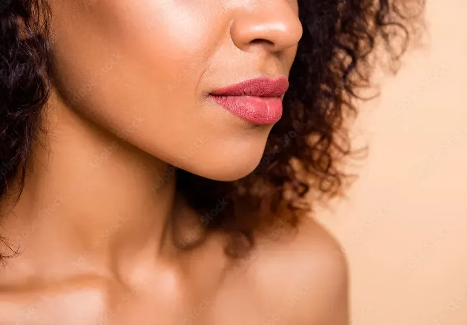 When to Choose a Lip Lift Over Fillers